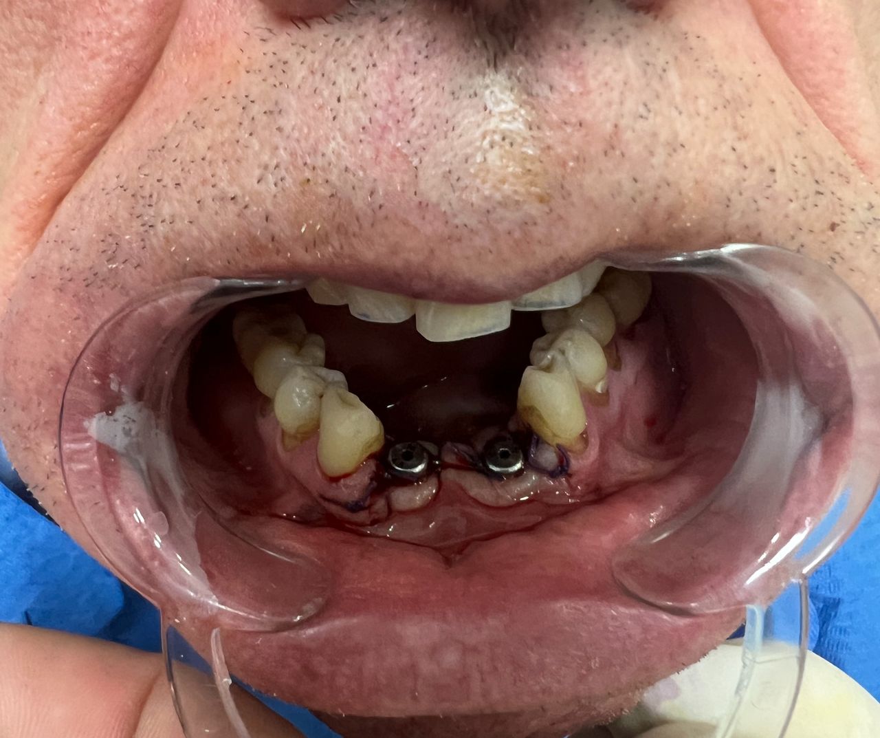 Luigi Aiardo Esposito-14