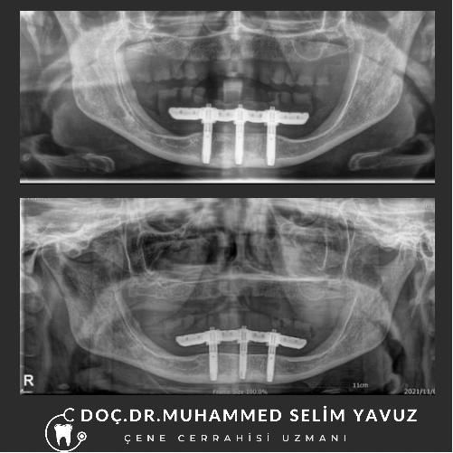 Muhammed Selim Yavuz-14