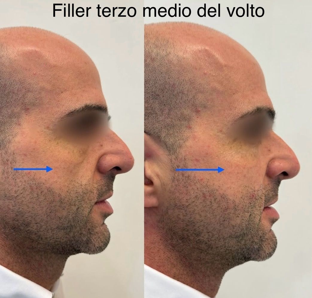 Raffaela Esposito-16