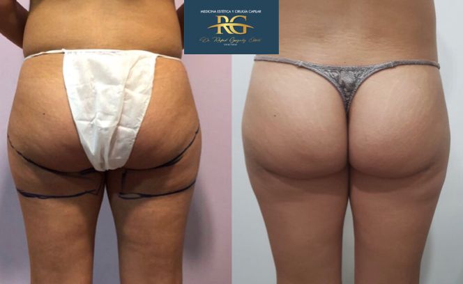 Rafael Gonzalez Oñate-11