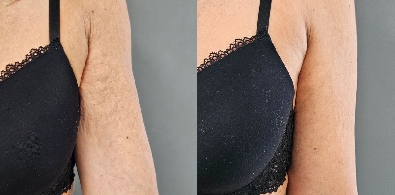 Rosalba Herrero Zerpa-551