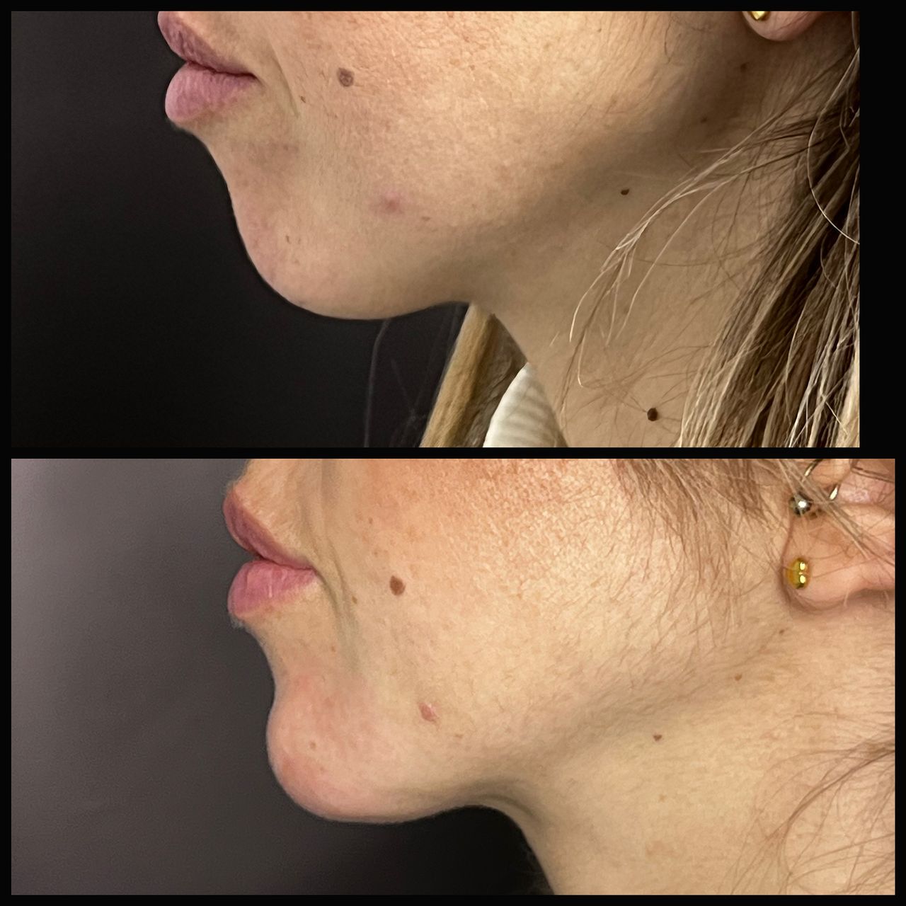 Salvatore Battaglia-12