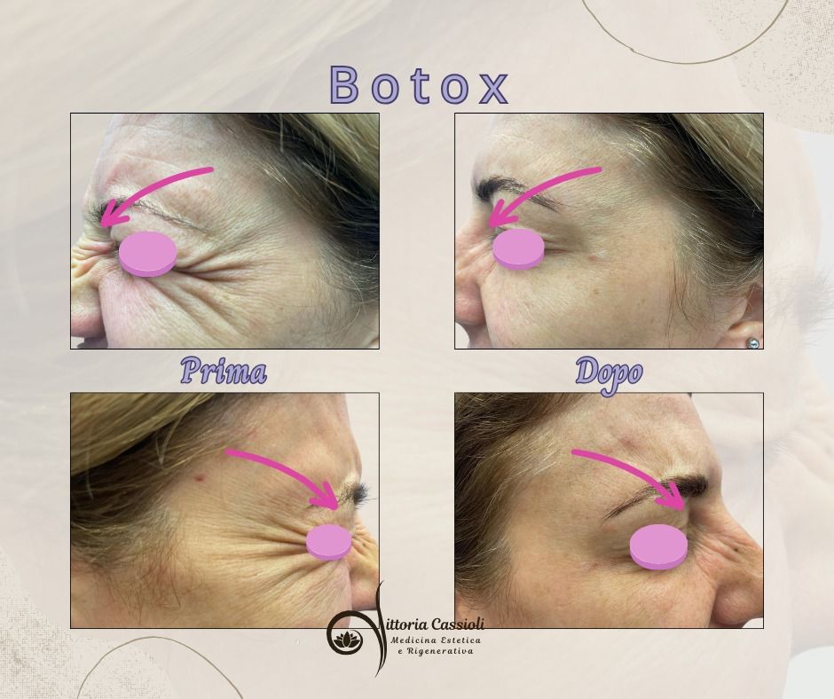 Vittoria Cassioli-52