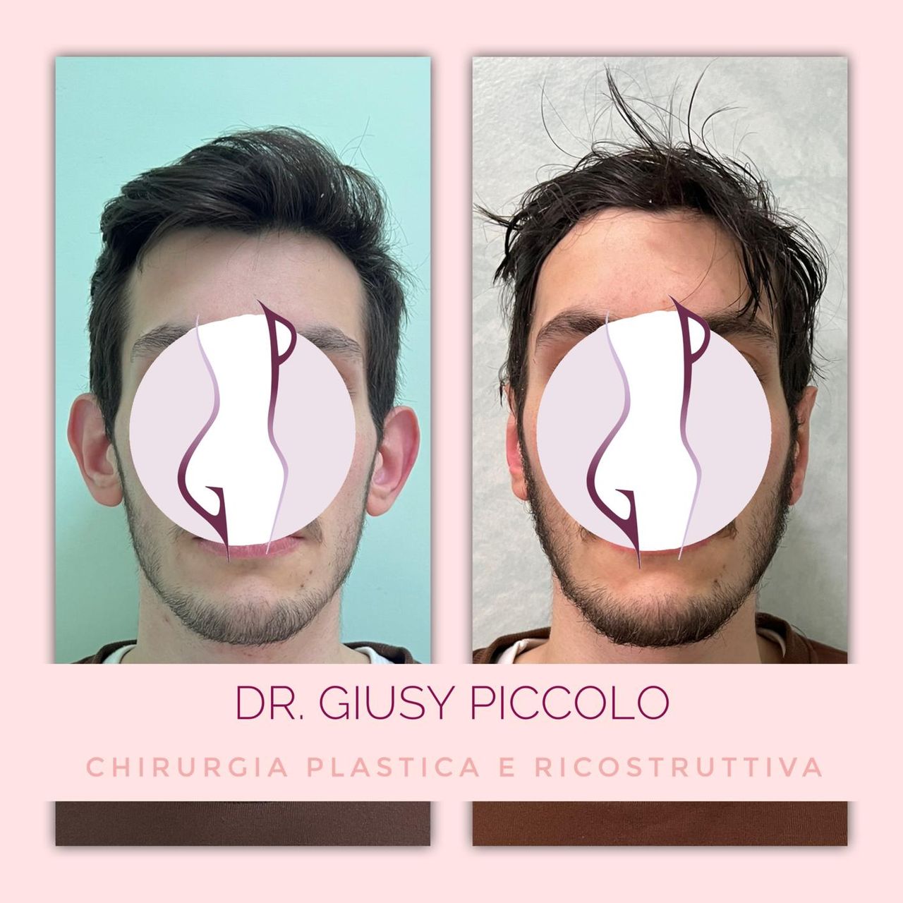 Giuseppina Piccolo-11