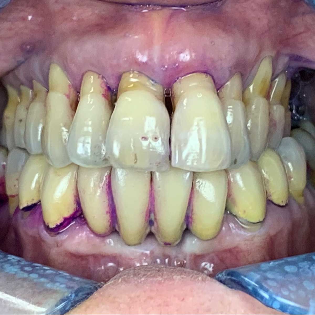 Gianluigi Bittante-82