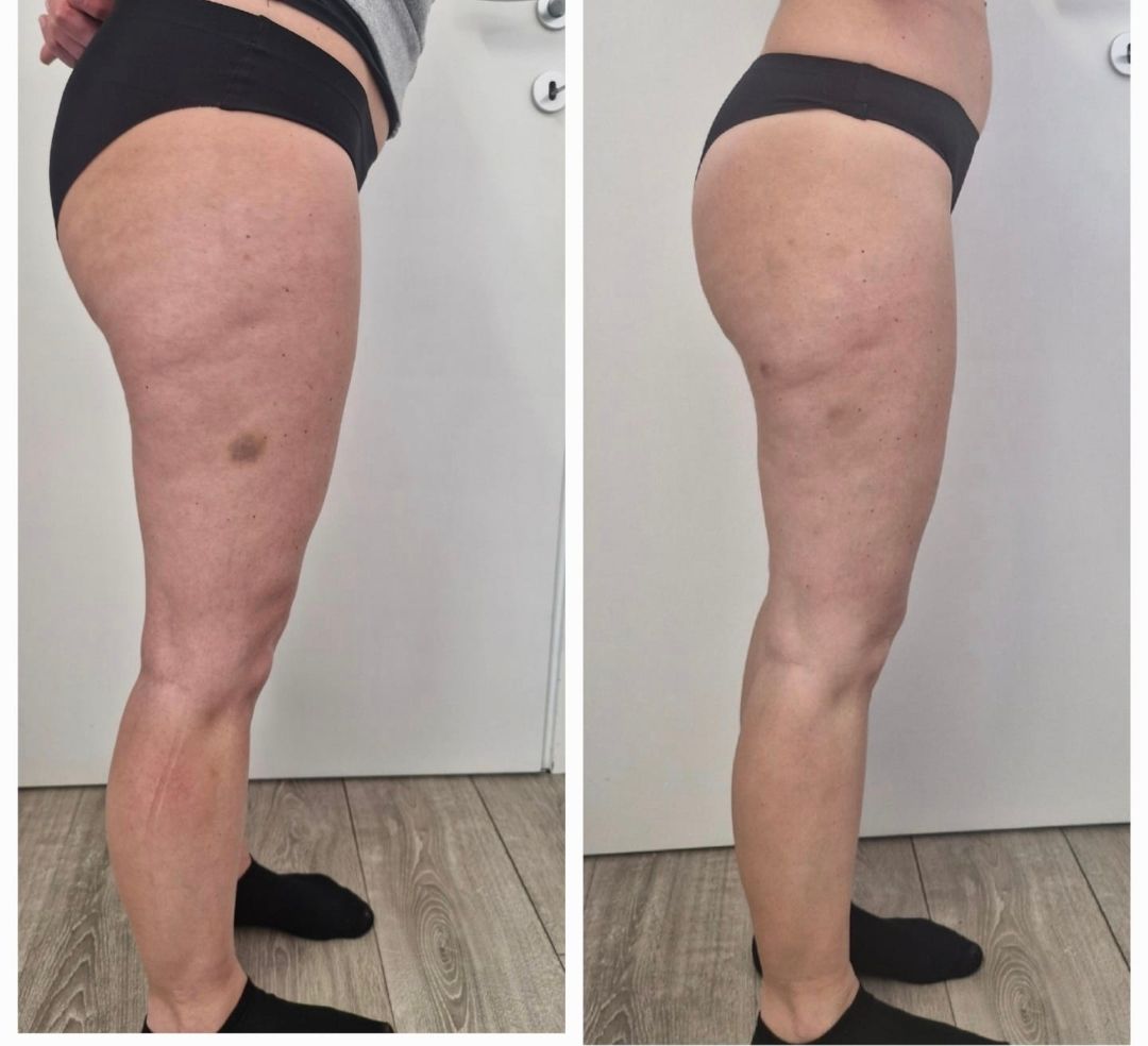 Guglielmina Chinaglia-8