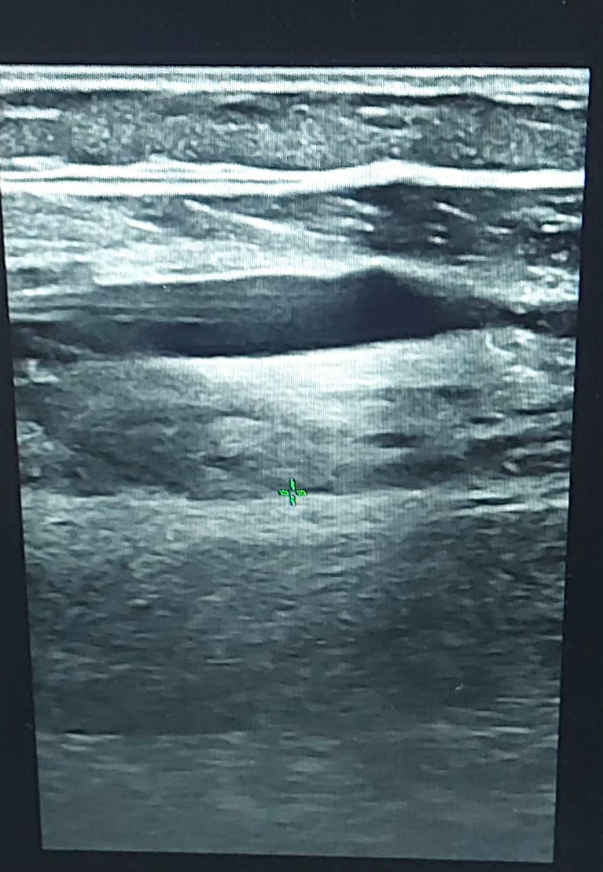 Álvaro Cerezuela Sánchez-12