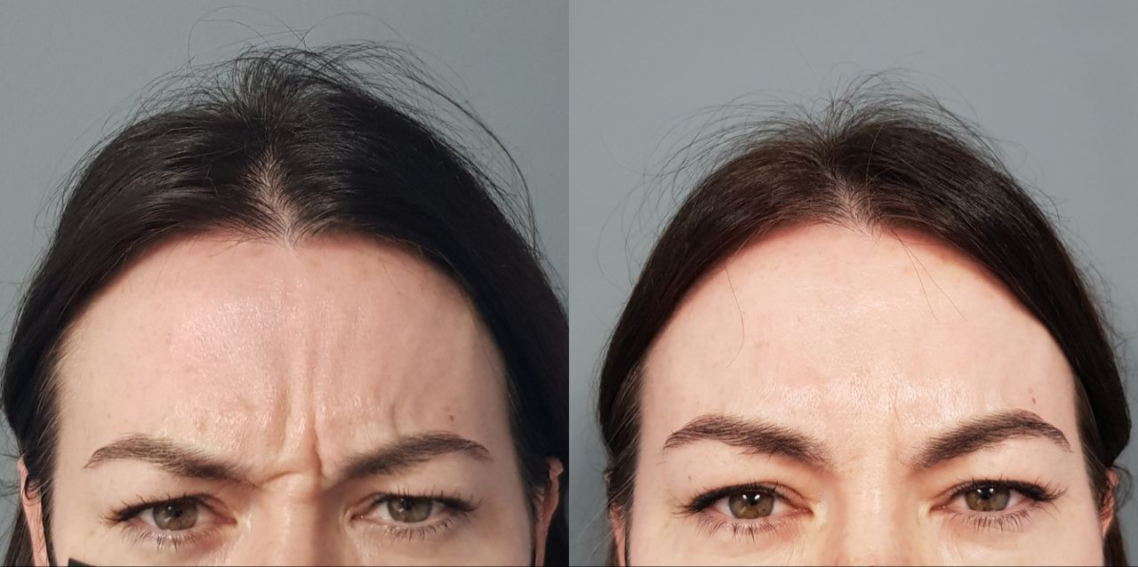 Rosalba Herrero Zerpa-119