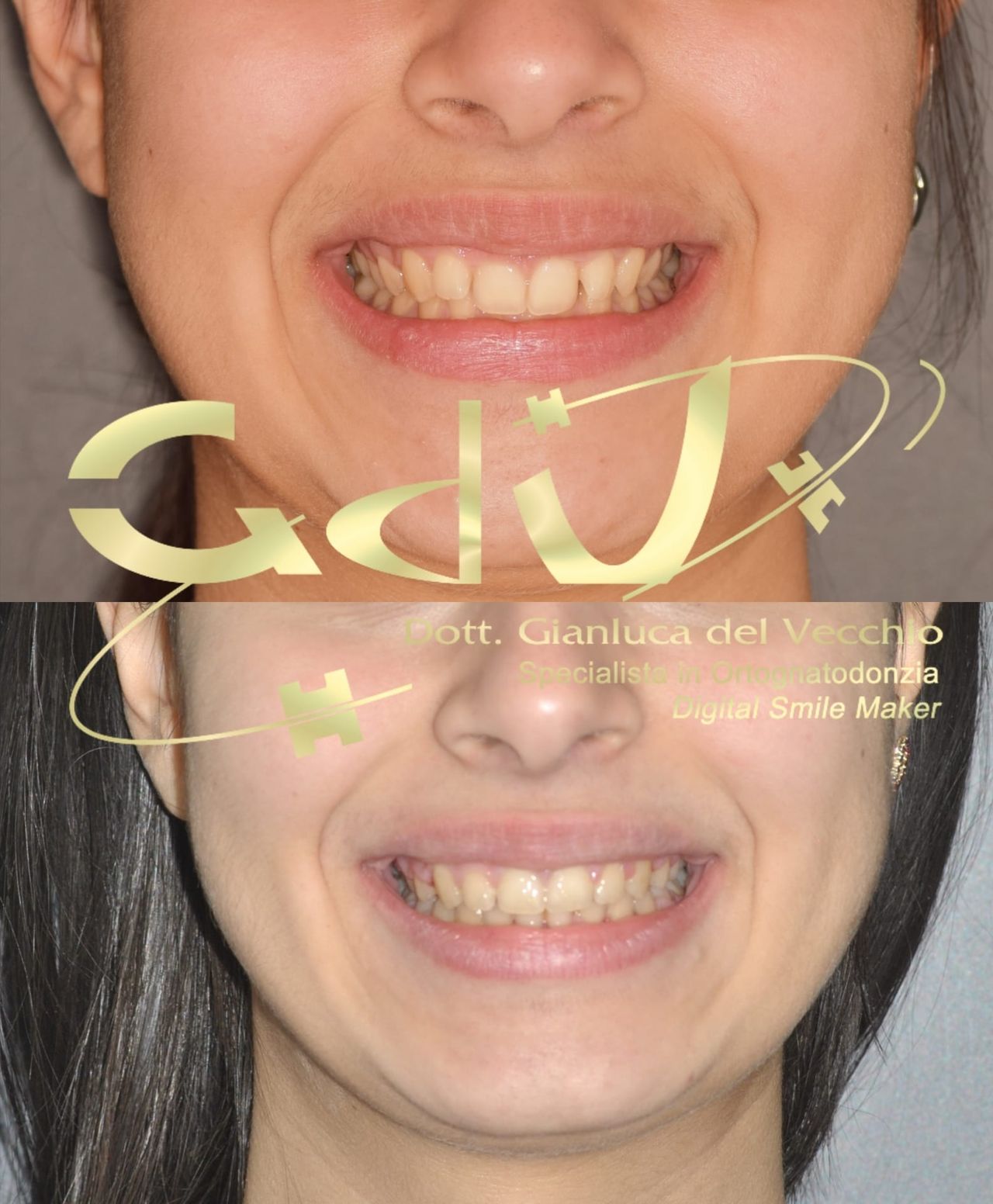 Gianluca Del Vecchio-179