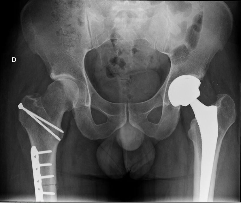 Luis Novoa Rodríguez-6