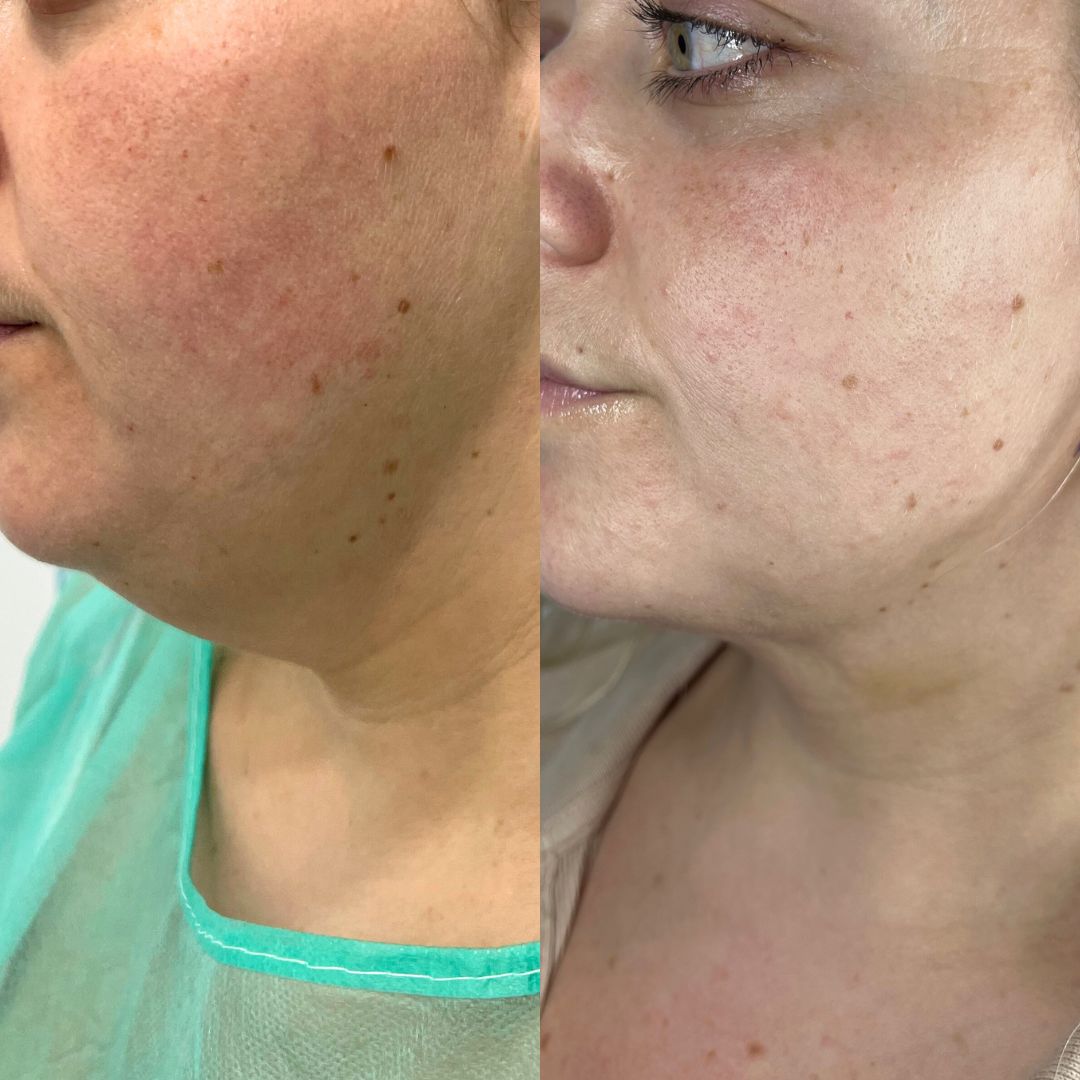 Juan Francisco Belén Montero-15