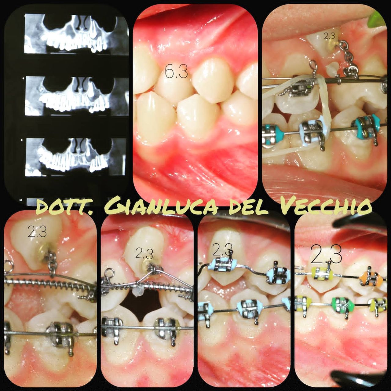 Gianluca Del Vecchio-34