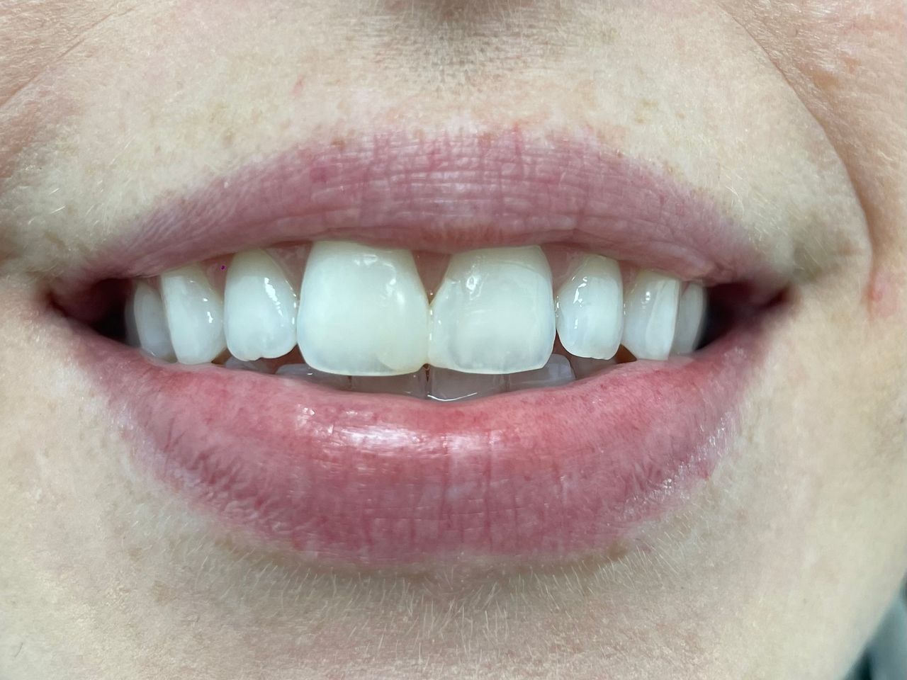 César Buján Riveiro-14