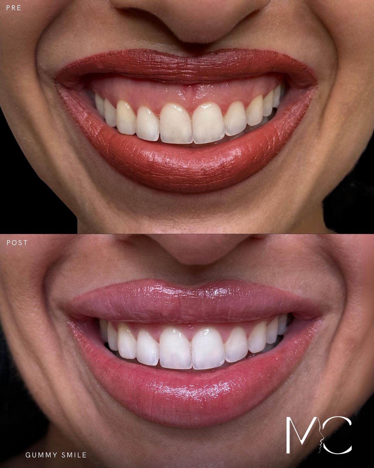 Maddalena Colecchia-6