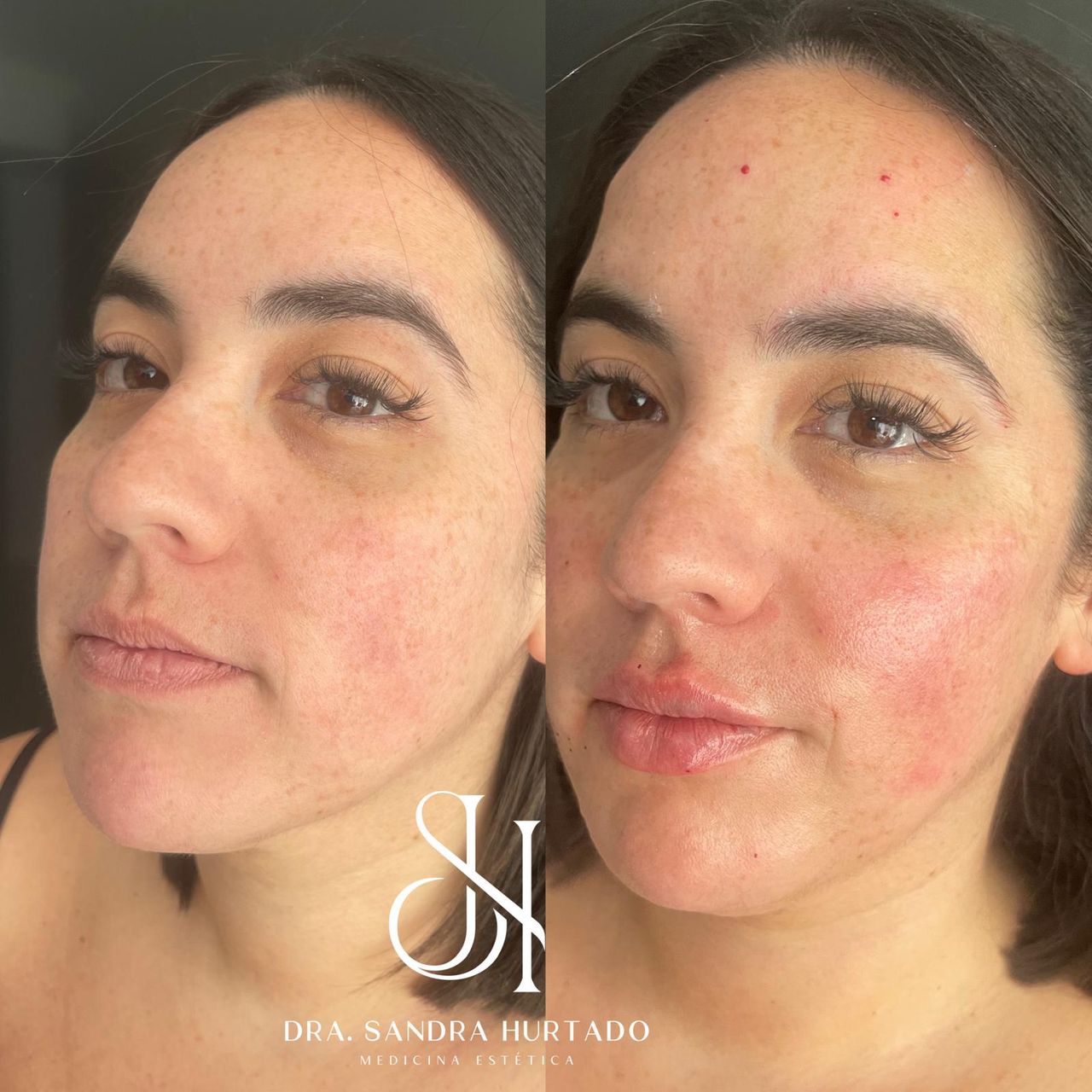 Sandra Hurtado Farreras-7