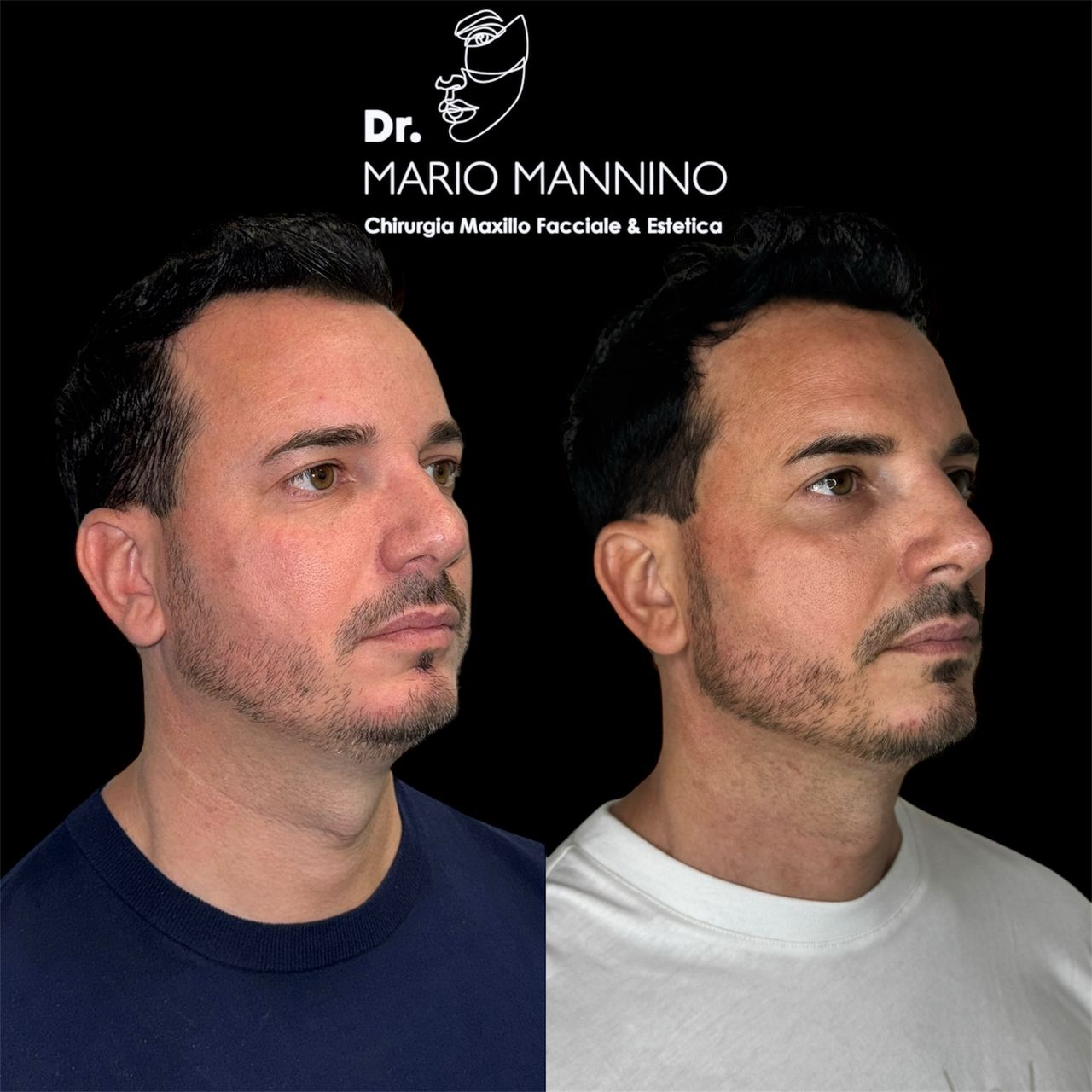 Mario Mannino-21