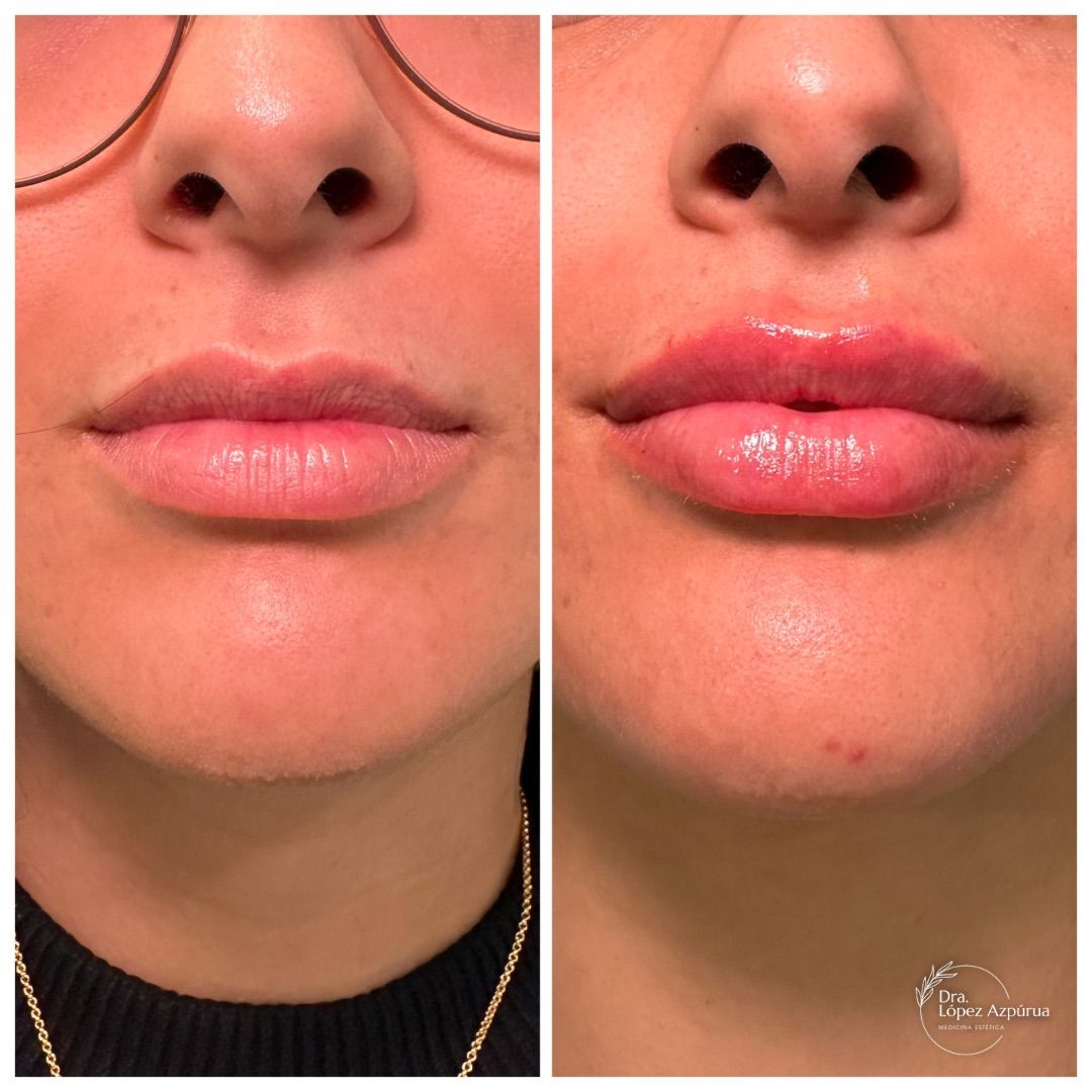 Alexandra López Azpúrua-9