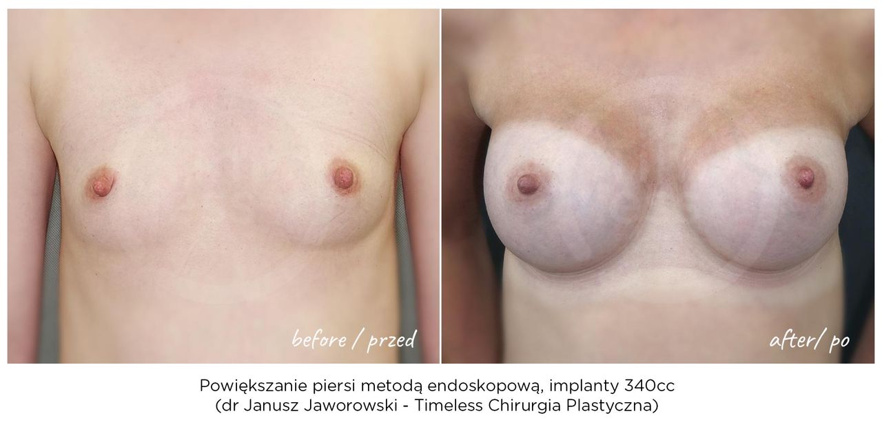 Janusz Jaworowski-159