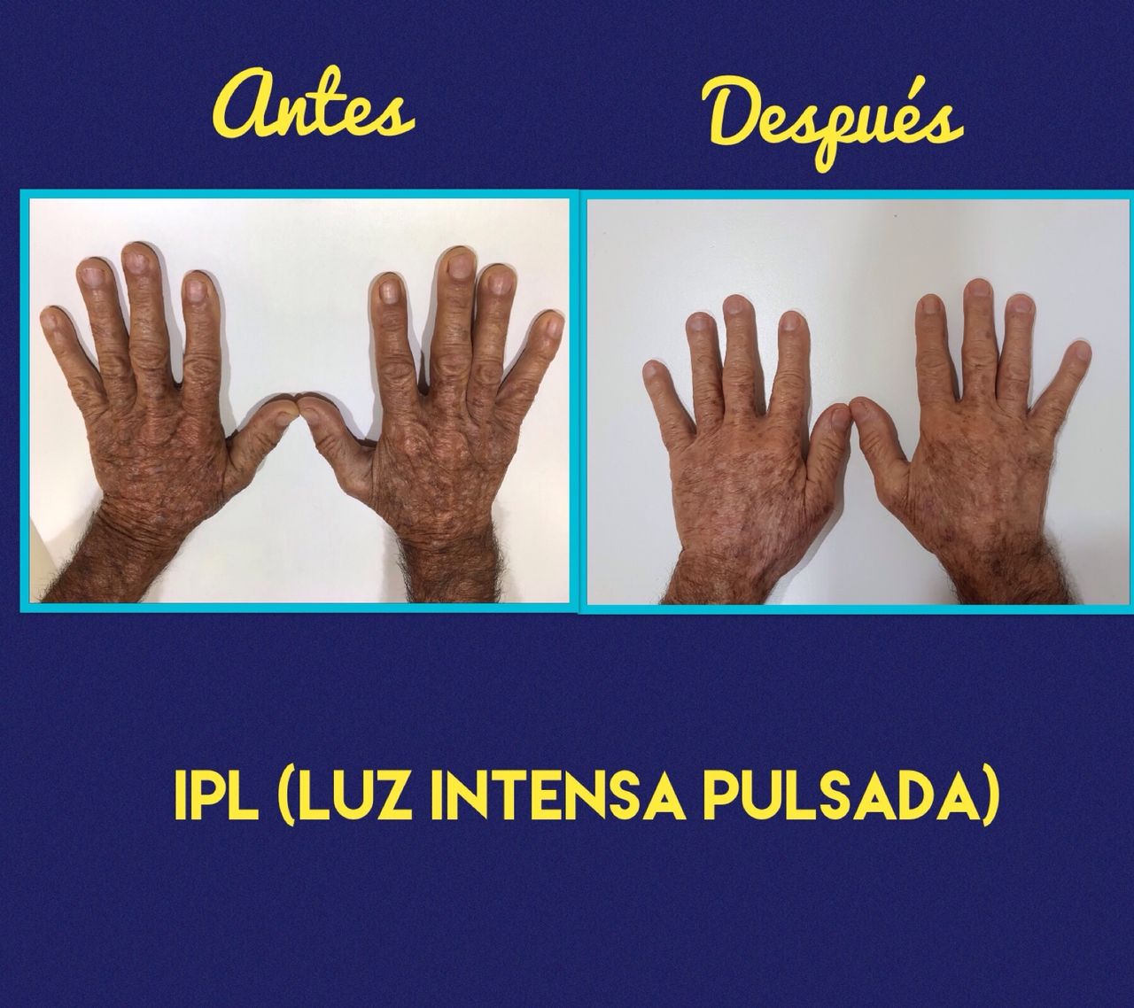 Rosalba Herrero Zerpa-420