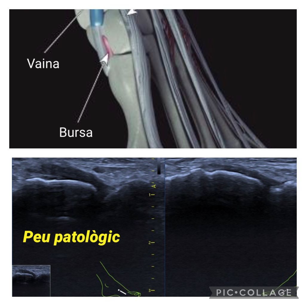 Mercè Garcia Lizandra-18
