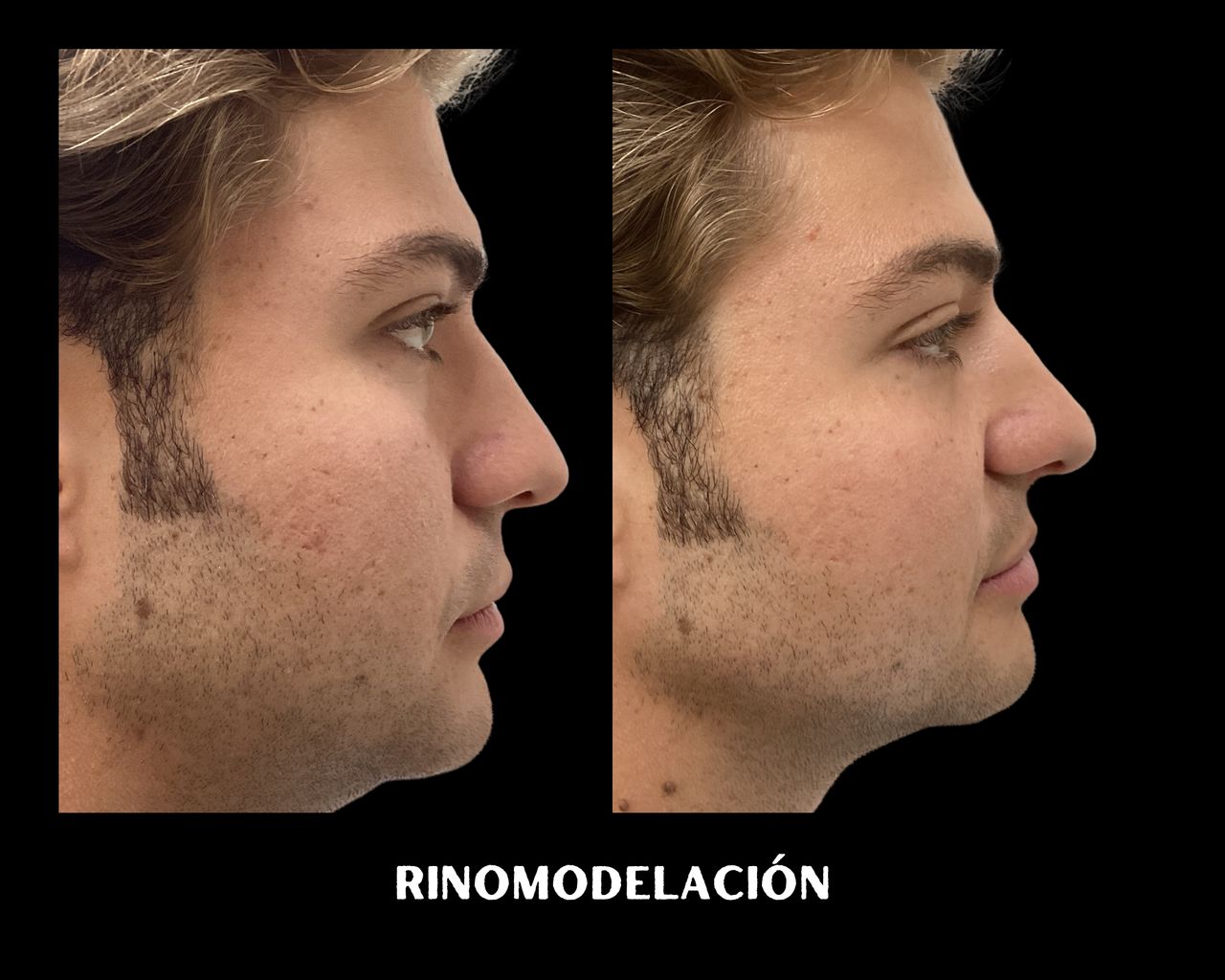 Arsenio Menchero Sánchez-30