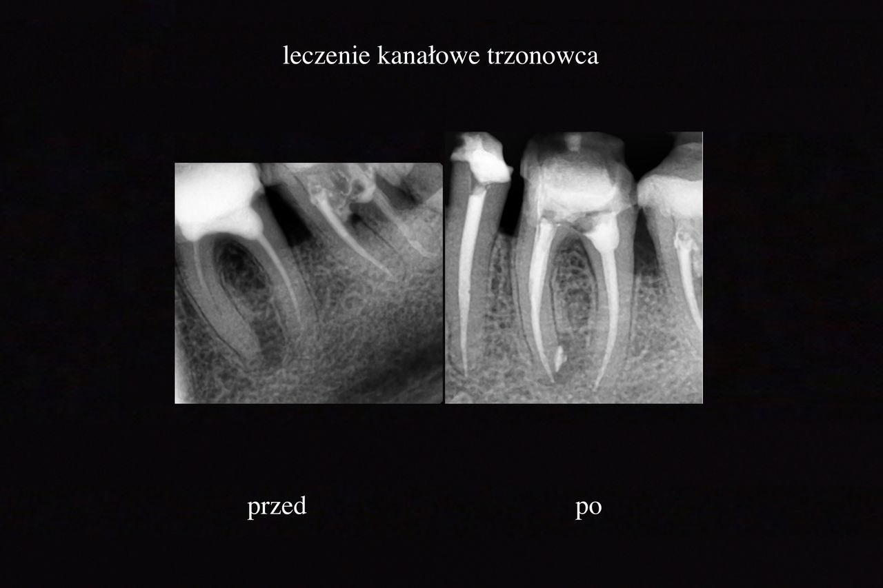 Grzegorz Wójcicki-8