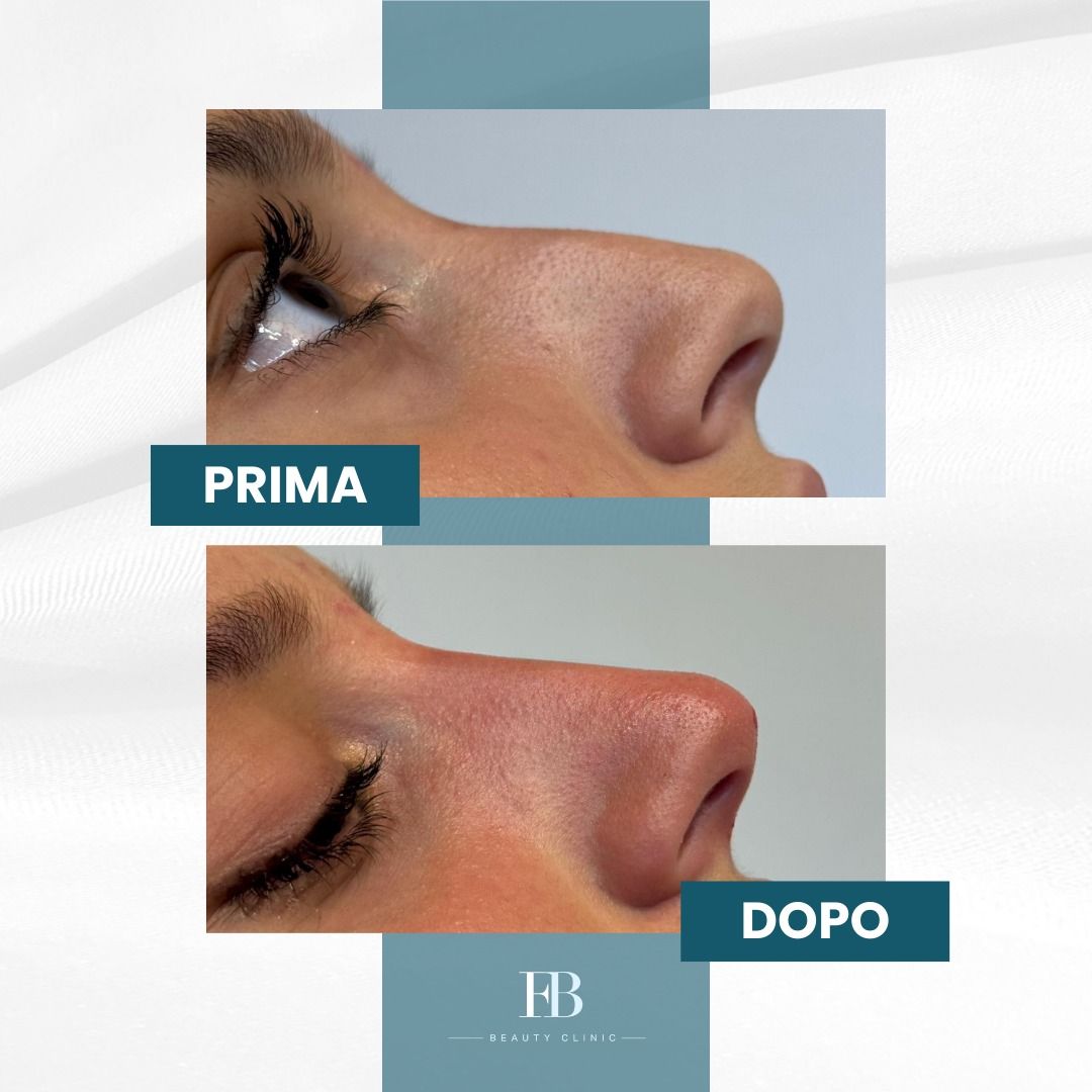 Francesco Bellucci-5