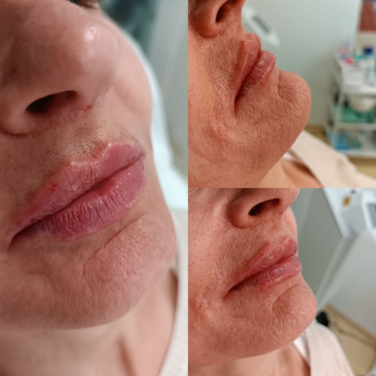 Michalina Zagańczyk-Bączek-0