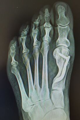 Ernesto Galán Fernández-10