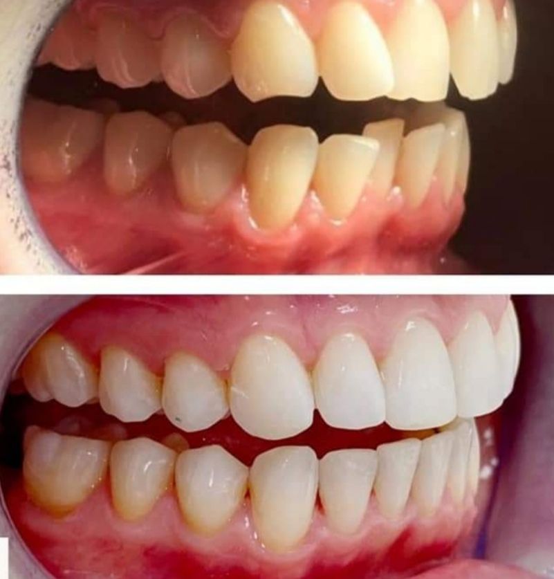 Alessandro Neglia-16