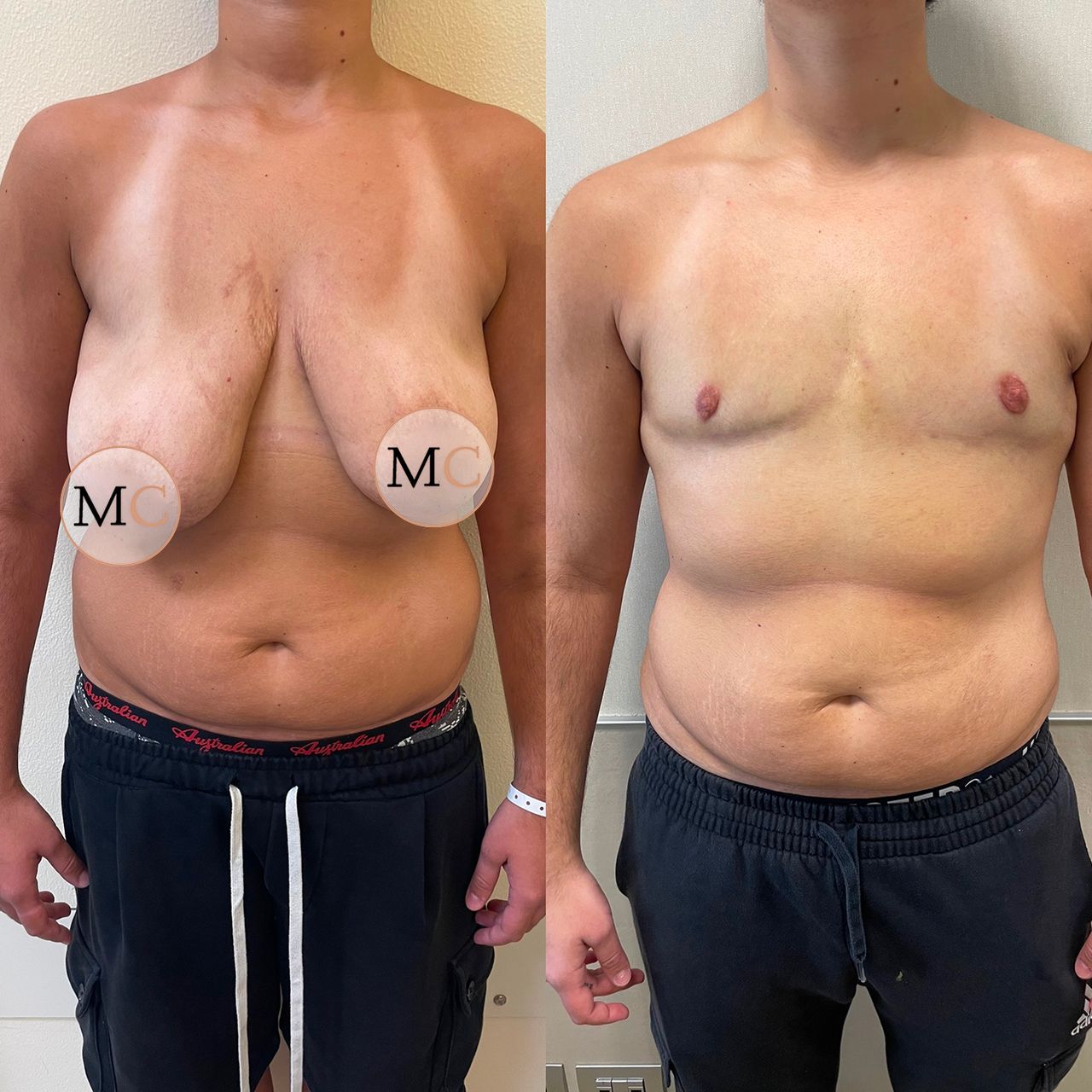 Marco Carmisciano-15