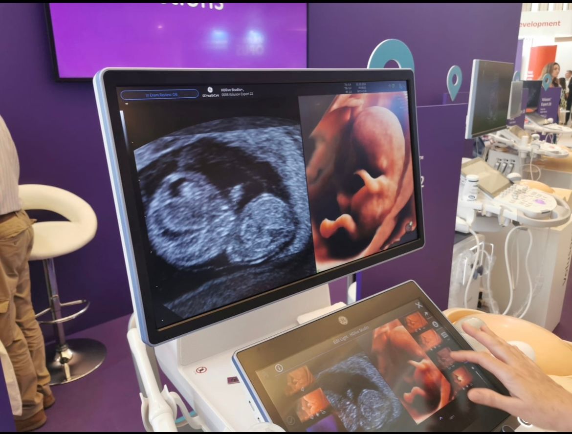 Wioletta Rozmus-Warcholińska-177