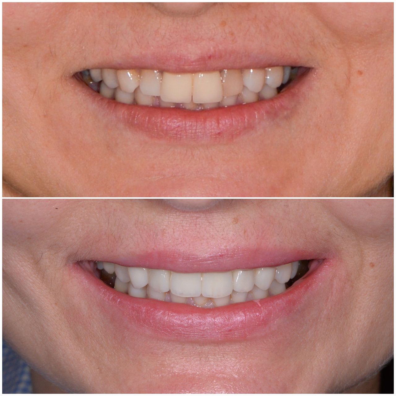 Martin Bartoszcze-14