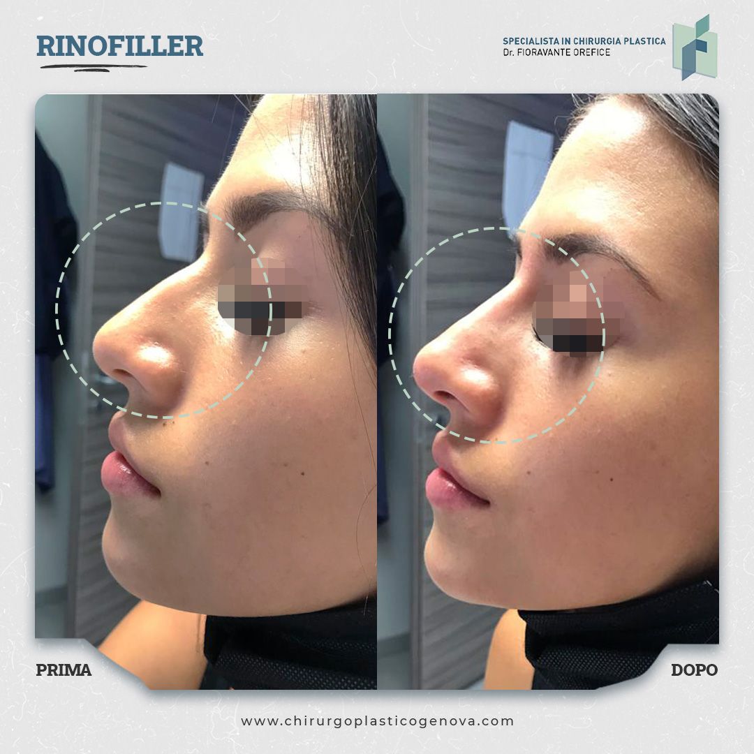 Fioravante Orefice-17