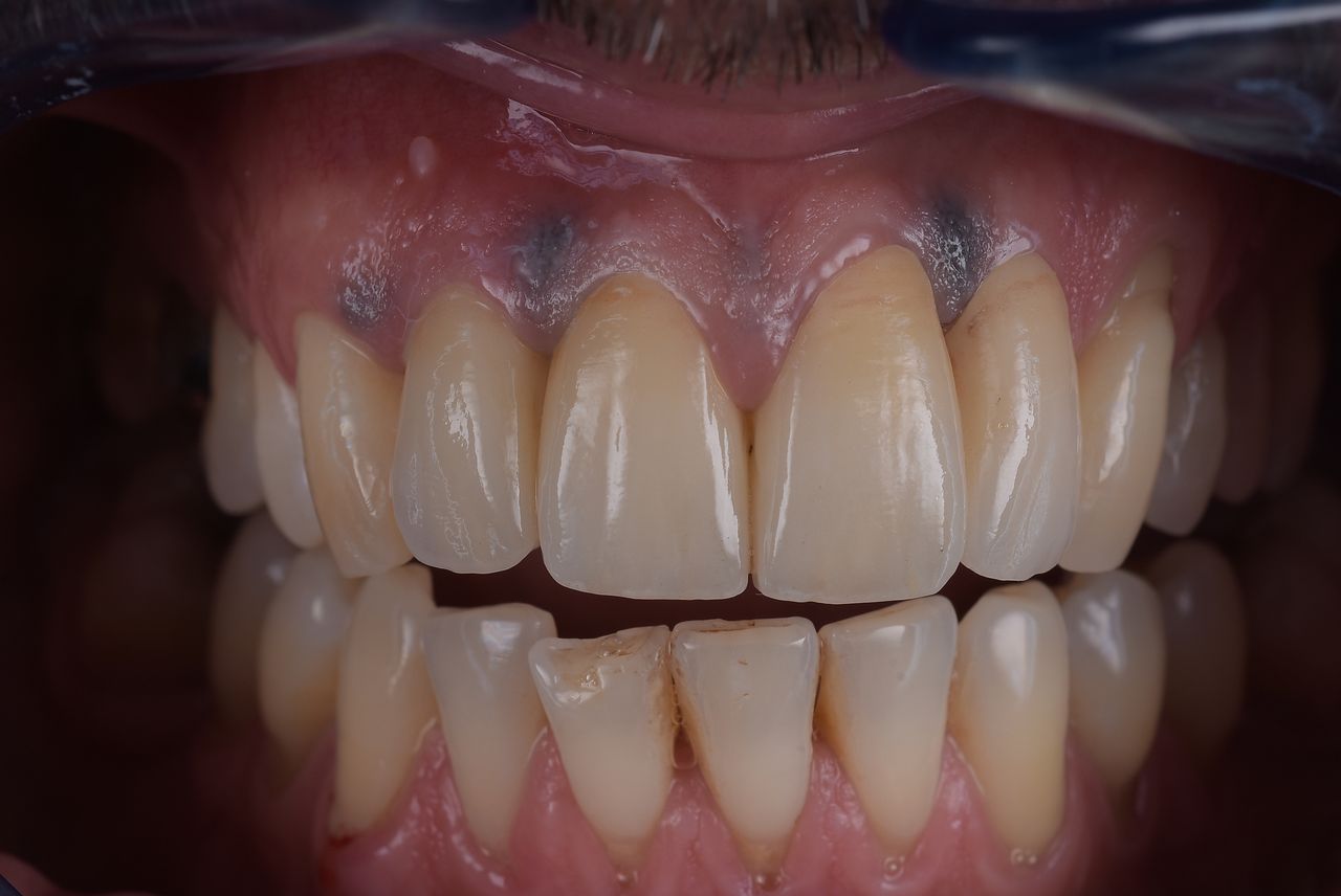 Riccardo Giardina-32