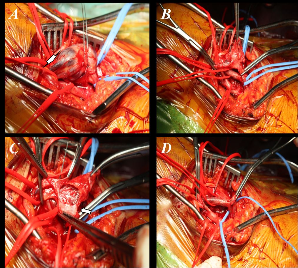 Francesco De Santis-9