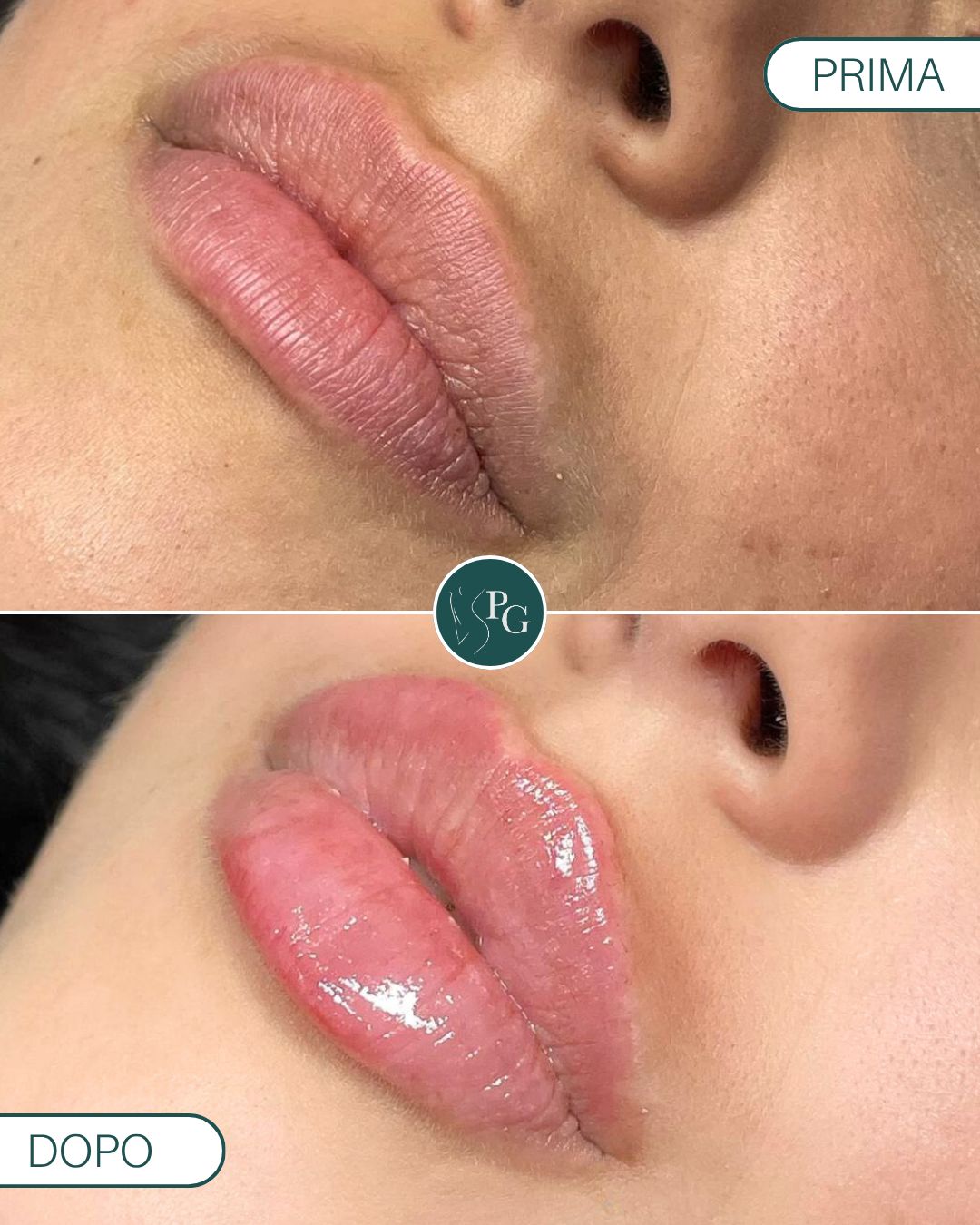 Pasquale Graziano-15