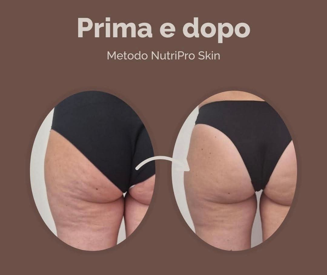 Guglielmina Chinaglia-4