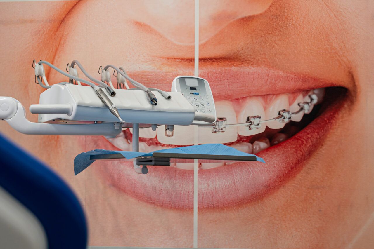 Vincenzo Santillo-40