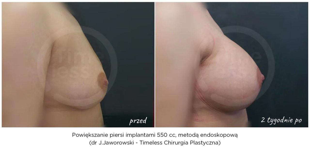 Janusz Jaworowski-107