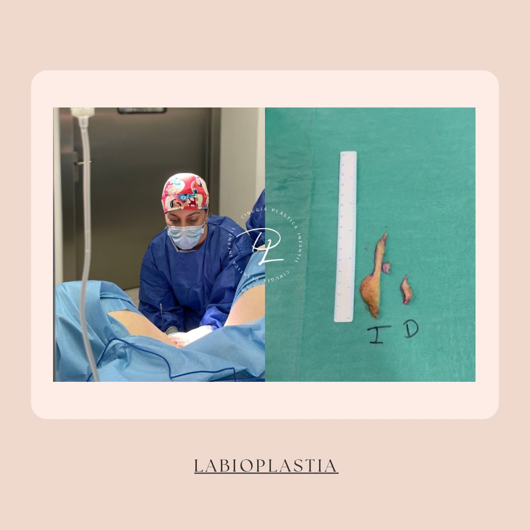 Concepción Lorca García-15