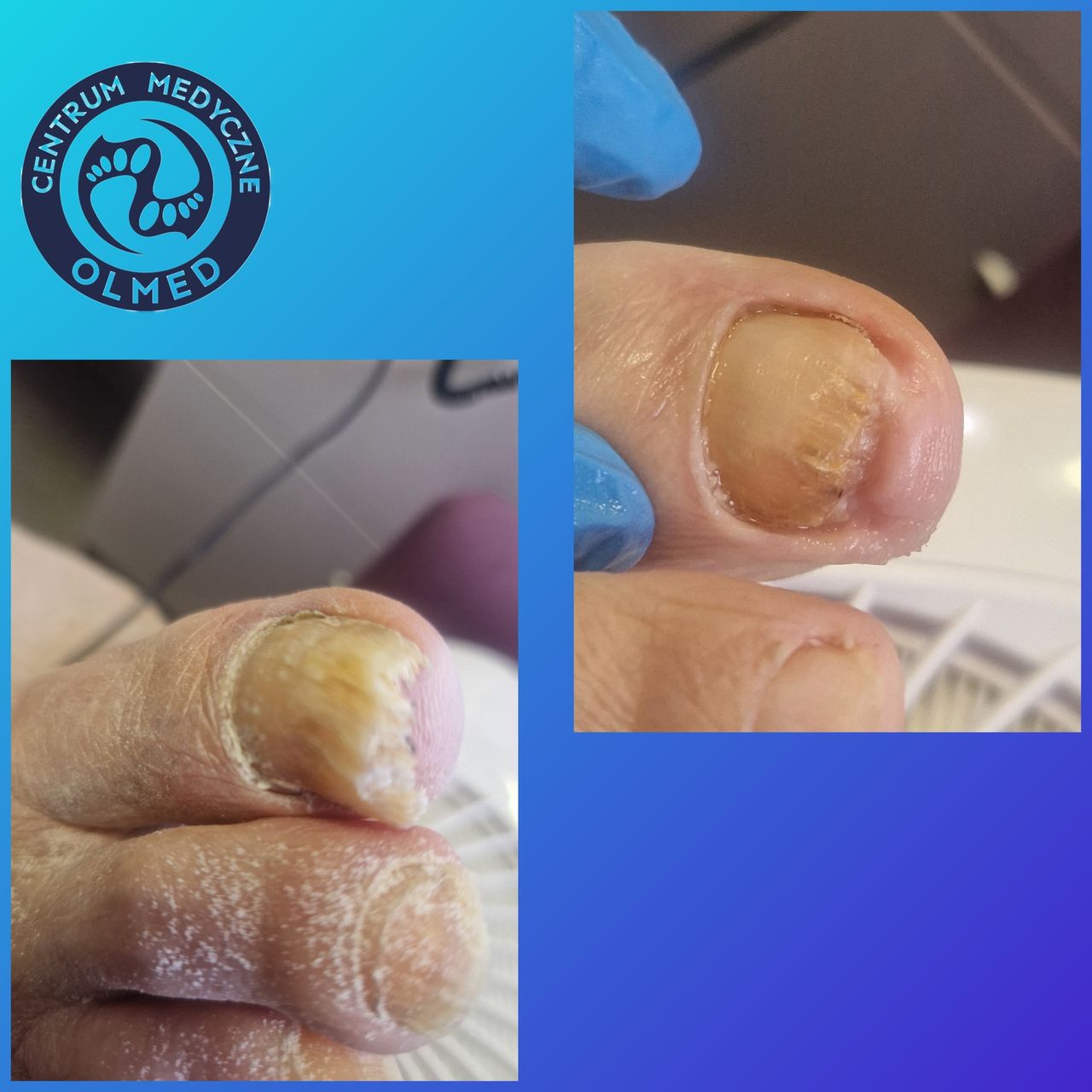 Aleksandra  Górecka -10