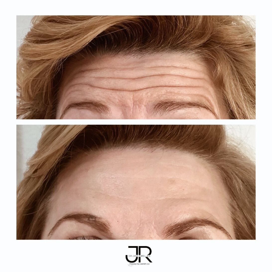 Javier Ribelles Alfonso-37