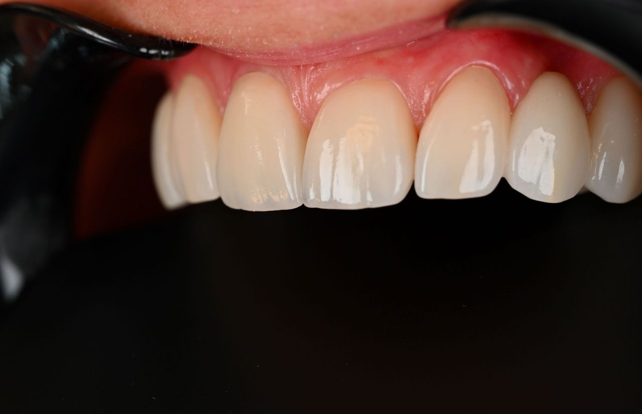 Magdalena Bińkowska-28