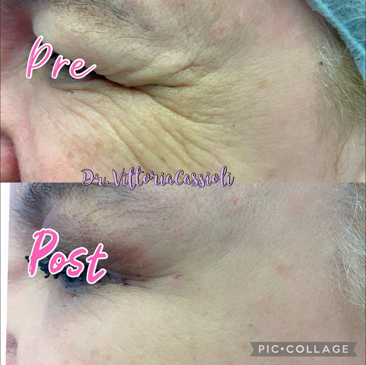 Vittoria Cassioli-68