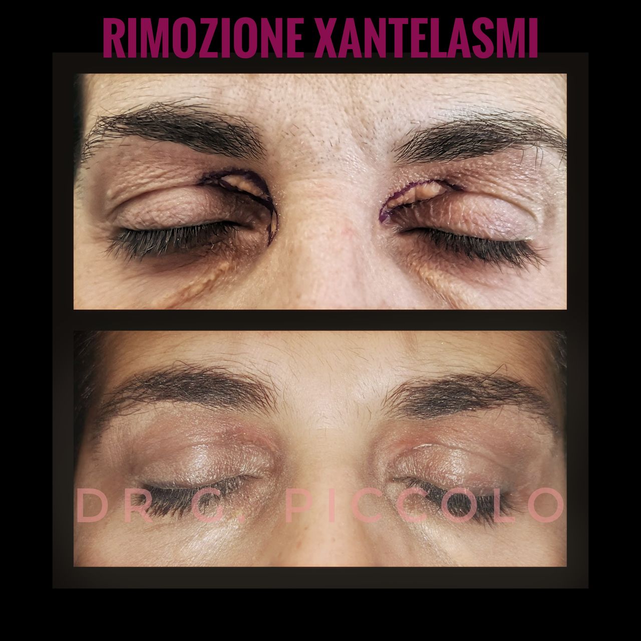 Giuseppina Piccolo-54