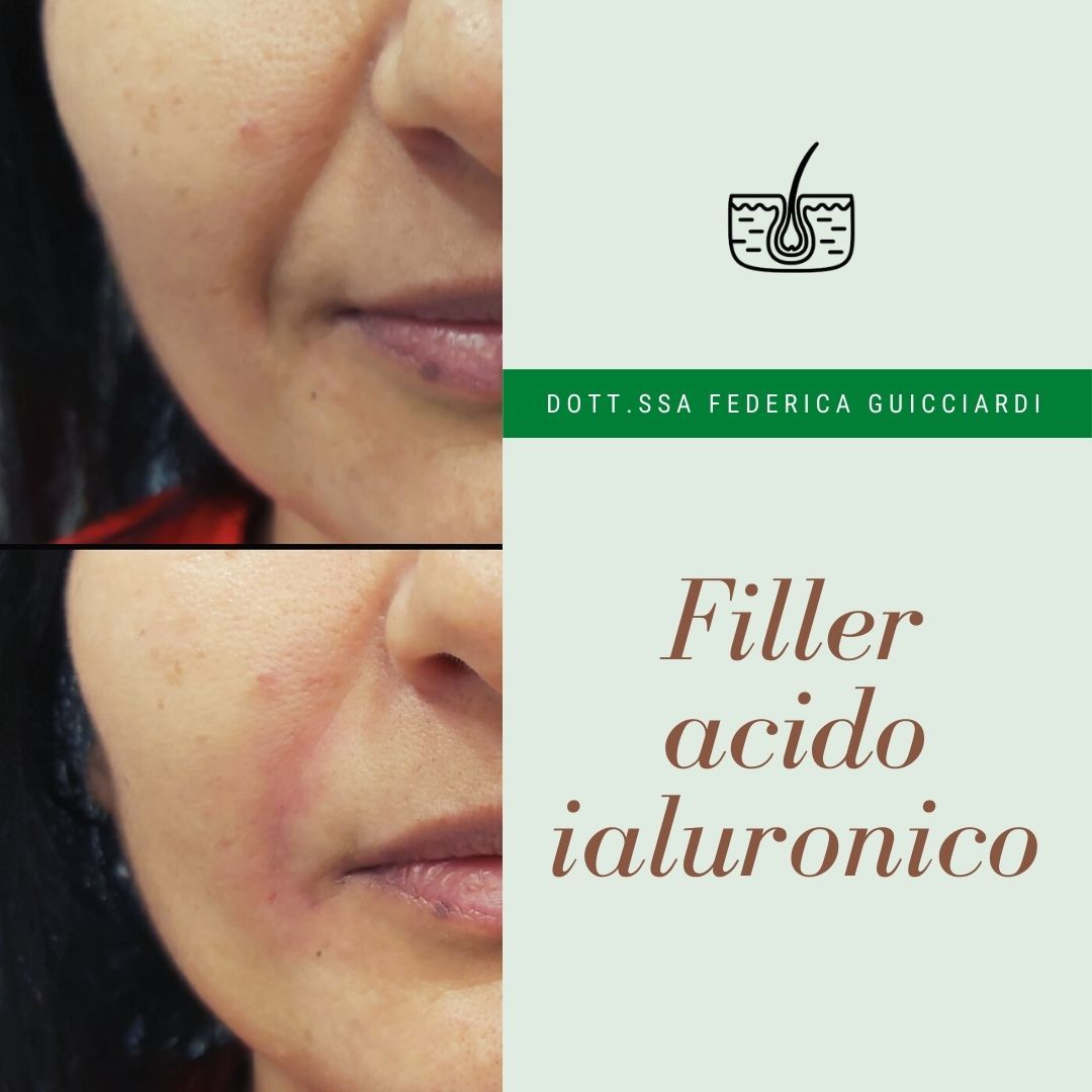 Federica Guicciardi-10