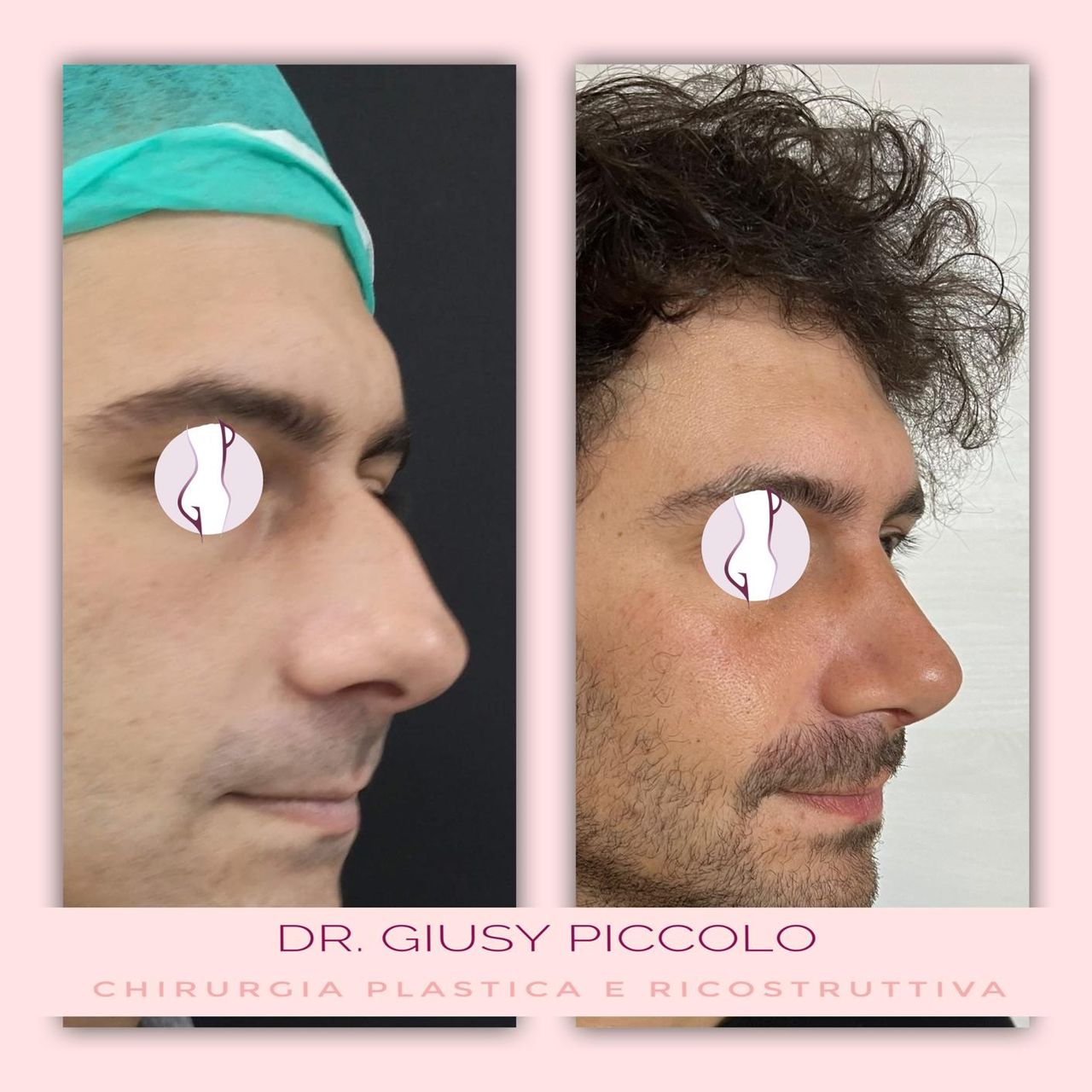 Giuseppina Piccolo-22