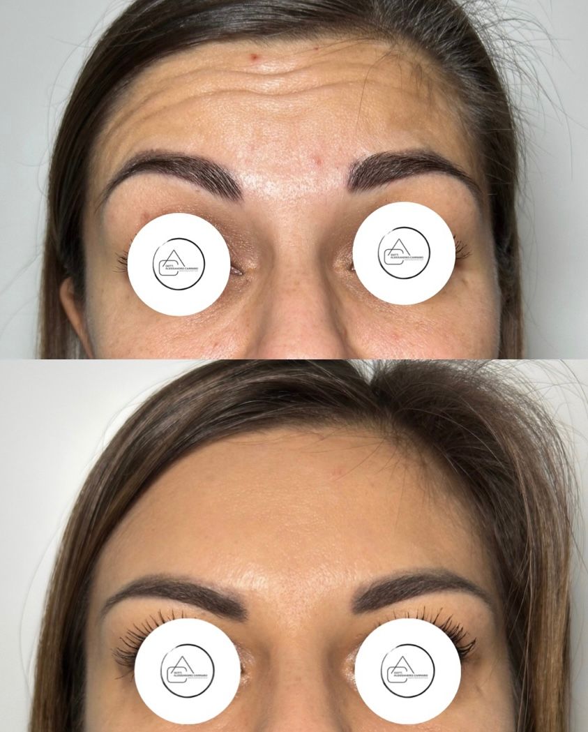 Alessandro Carraro-8