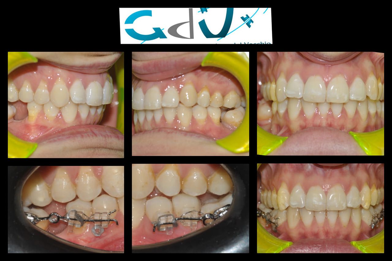 Gianluca Del Vecchio-138